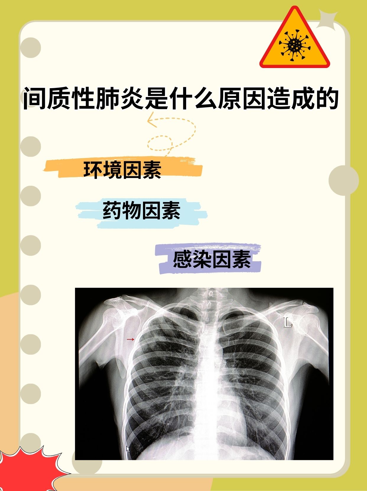 “2019年新型肺炎爆发	” 2019新型肺炎叫什么名字？-第2张图片